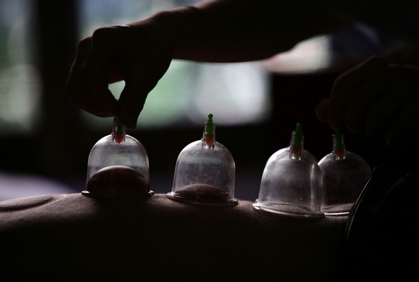 Cupping_2